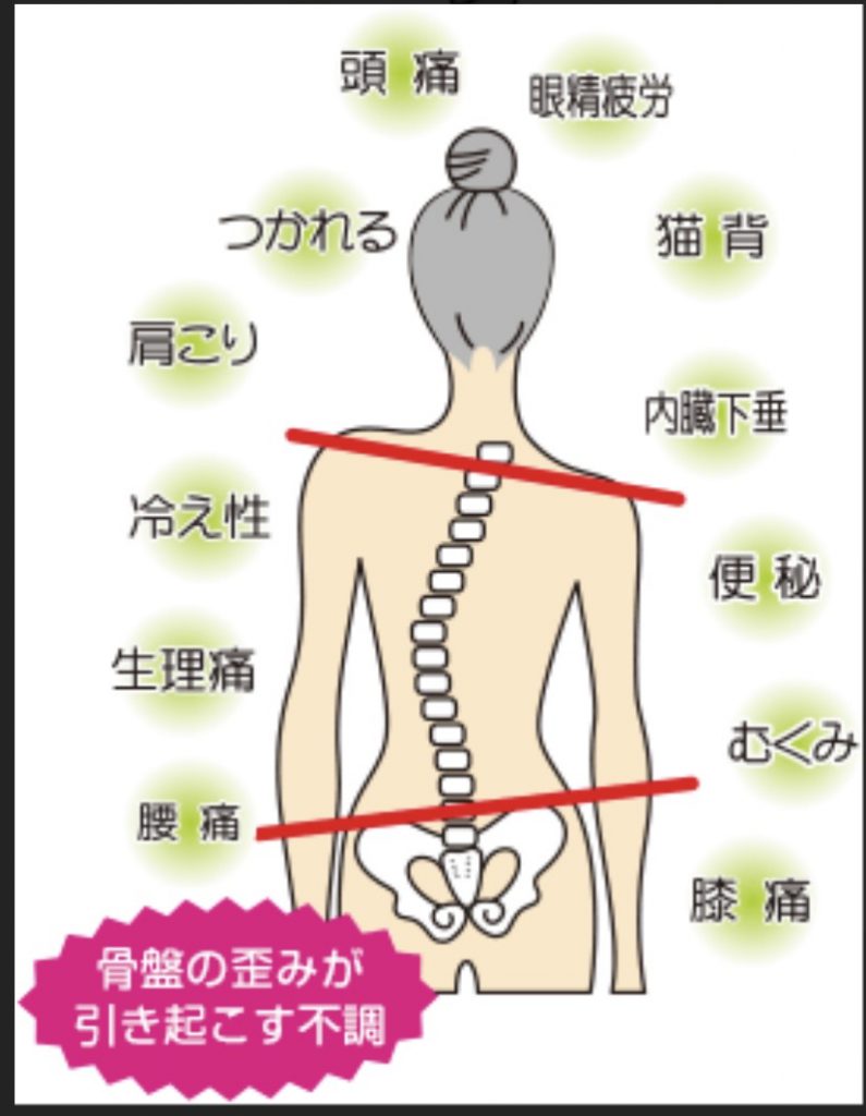 骨盤調整体験_4