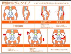 骨盤調整体験_2